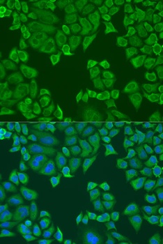 PABPC4 Antibody