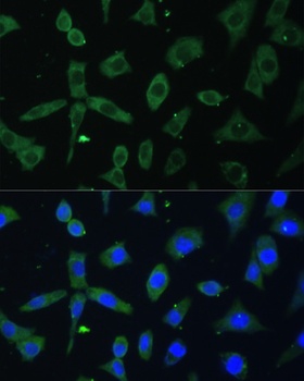 EIF3D Antibody