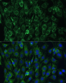 EIF3D Antibody