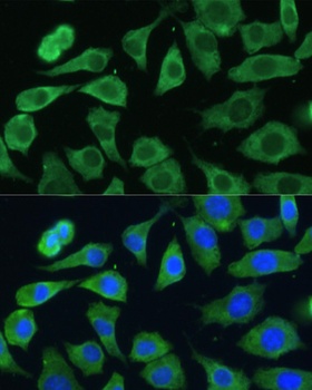 EIF3D Antibody