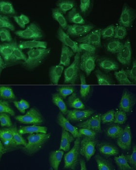 EIF3D Antibody