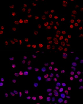 HNRNPH1 Antibody