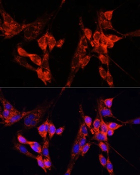 ETF1 Antibody