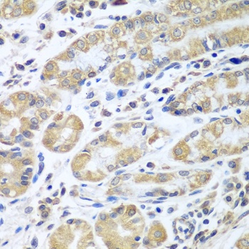 EIF1AX Antibody