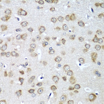 EIF1AX Antibody