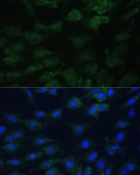 EIF1AX Antibody