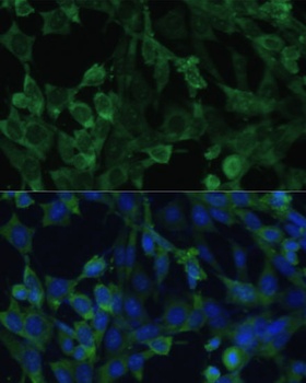 EIF1AX Antibody