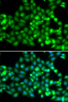 TRIM69 Antibody