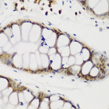 NCL Antibody