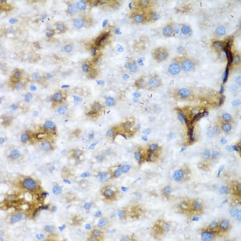 NCL Antibody