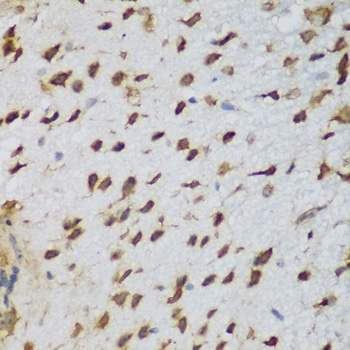 NCL Antibody