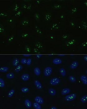 NOLC1 Antibody