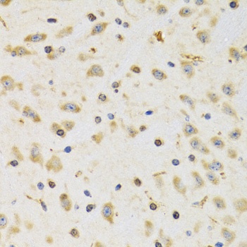 RPS12 Antibody