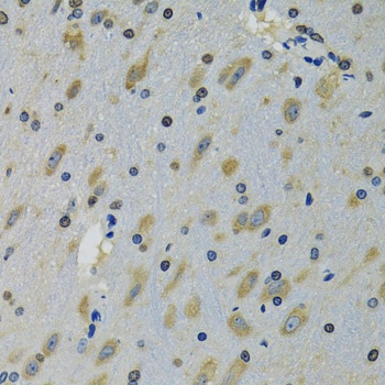 RPS12 Antibody