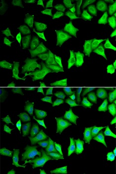 RPS12 Antibody