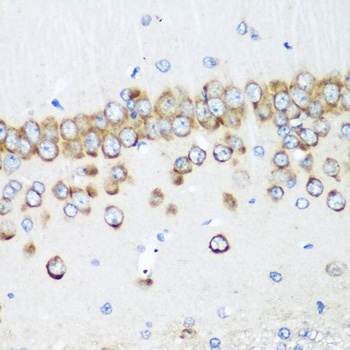 MTDH Antibody