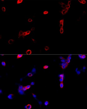 ATP5A1 Antibody