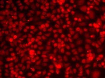 ILF2 Antibody