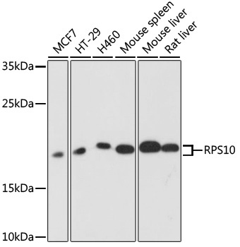 RPS10 Antibody