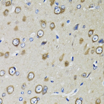 RPS10 Antibody