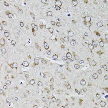 RPS10 Antibody