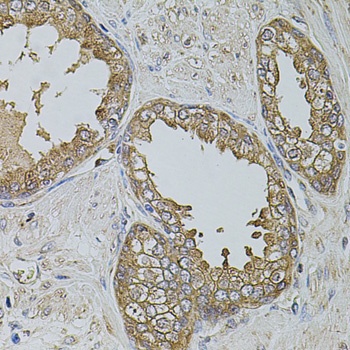 KTN1 Antibody