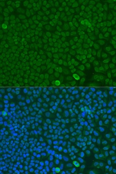 FBXW7 Antibody