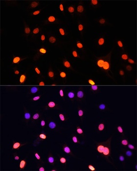 pan Kme2 Antibody