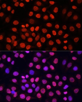 pan Kme2 Antibody