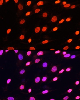 pan Kme2 Antibody