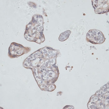 TFRC Antibody