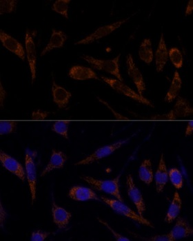 TFRC Antibody
