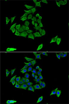 TGM3 Antibody