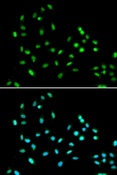 SMARCAD1 Antibody