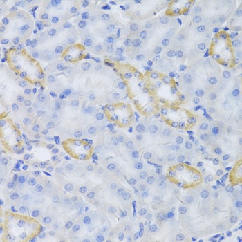 MRPS30 Antibody