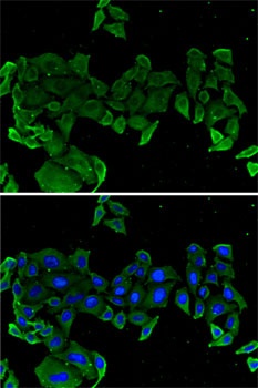 COMP Antibody