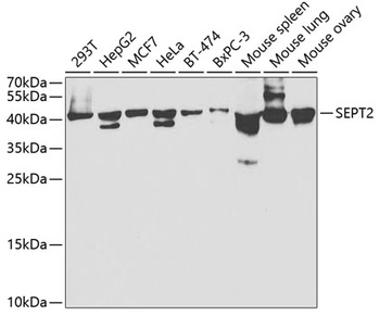 SEPT2. Antibody