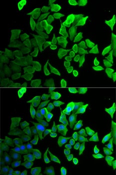 SEPT2. Antibody