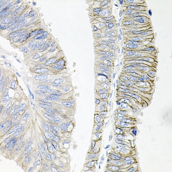 ATP1B1 Antibody