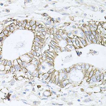 ATP1B1 Antibody