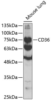 CD36 Antibody