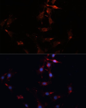 CD36 Antibody