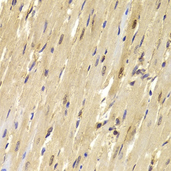 TOPBP1 Antibody