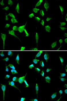 TOPBP1 Antibody