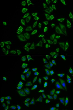 PEX5 Antibody