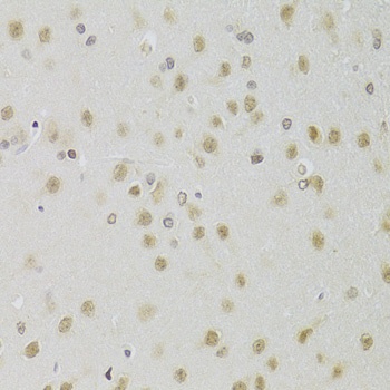 HEXIM1 Antibody