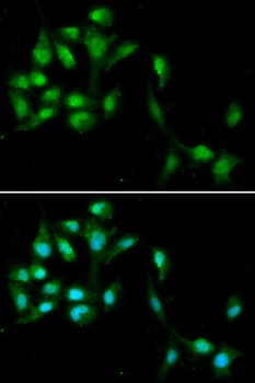 HEXIM1 Antibody