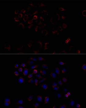 ATP5B Antibody