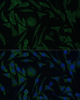 ATP5B Antibody