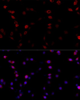 ATP5B Antibody